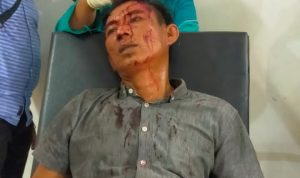 Pecah Kepala, Warga Gesekan di Pintu Masuk Perkebunan PT HIM Pecah Kepala, Warga Gesekan di Pintu Masuk Perkebunan PT HIM